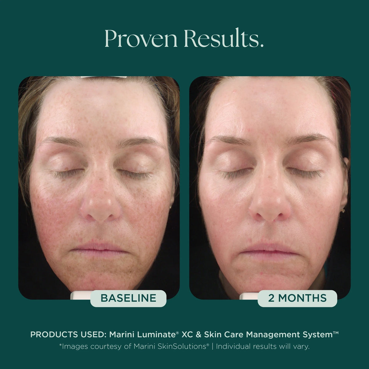 Marini Luminate®